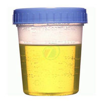 Slika Lonček za urin, sterilen