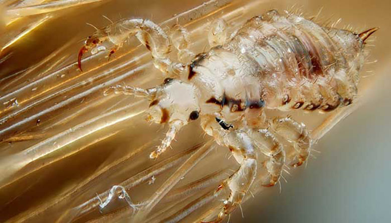 Picture of UŠI pri otroku