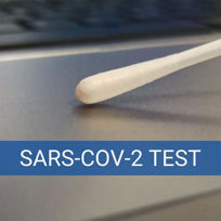 Slika Hitri antigenski test za detekcijo SARS-CoV-2 na površinah, 10 testov