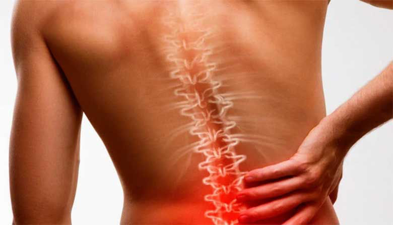 Picture of Bolečine v križu in bolečina v žlički