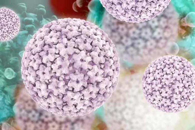 Picture of Bradavica - vse o genitalnih, navadnih in bradavicah na nogah