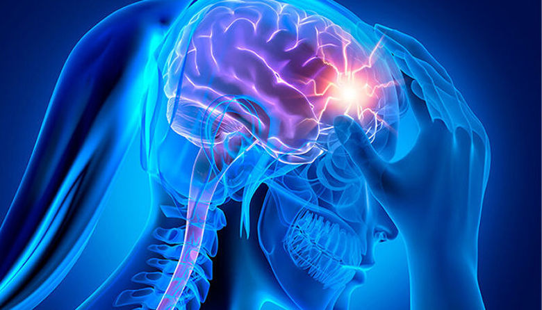 Picture of MIGRENA - zakaj tako boli, zakaj je nevarna?