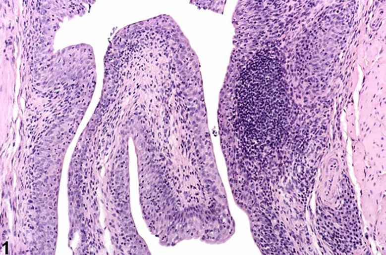 Picture of Vnetje mehurja in VSE povezane težave!