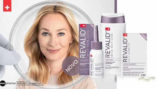 Vam izpadajo lasje? Preverite teh 5 nasvetov