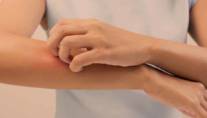 Glivice: Kaj so, vrste glivic, vzroki in zdravljenje