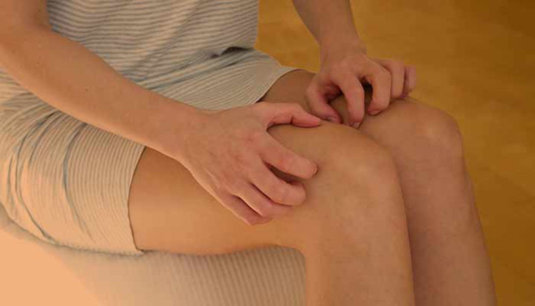 Picture of Srbeča koža na nogah