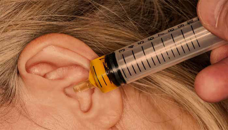 Picture of Kako odmašiti čep v ušesu