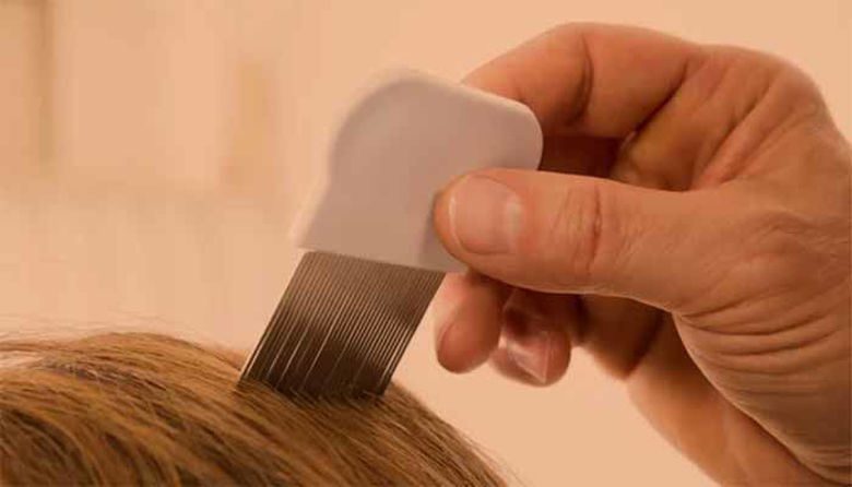 Picture of Kako se znebiti uši