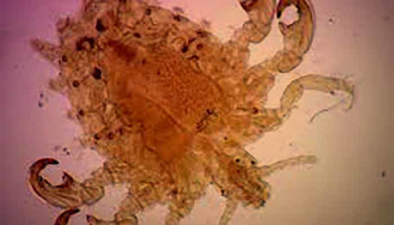 Picture of Sramne uši