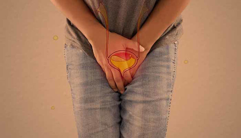 Picture of Inkontinenca