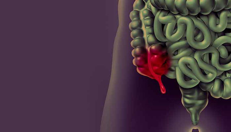 Picture of VNETJE SLEPIČA: ZNAKI za hitro ukrepanje, Zdravljenje in Vzroki