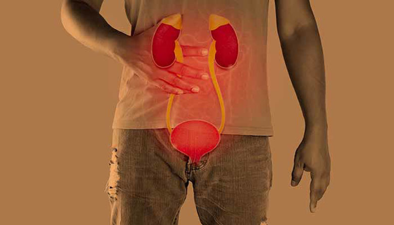 Picture of Vnetje mehurja lekarna