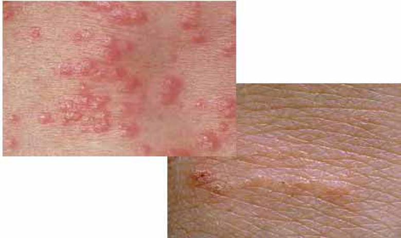 Picture of Garje slike