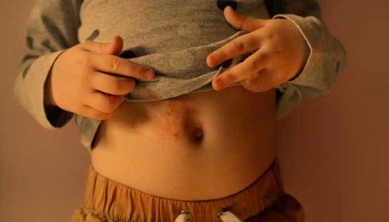 Picture of Garje pri otrocih