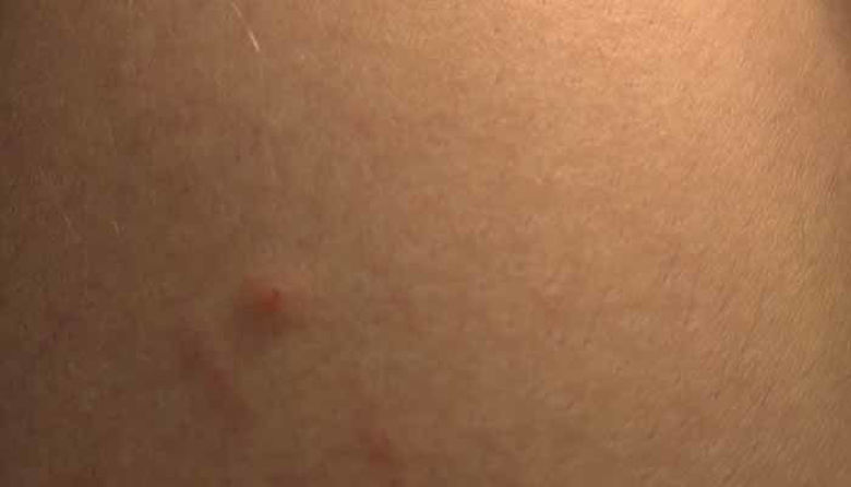 Picture of Garje pri ljudeh