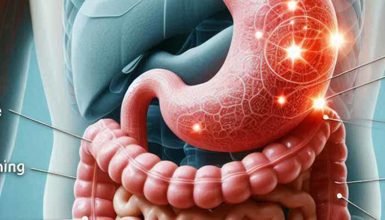 Picture of Stresni gastritis simptomi