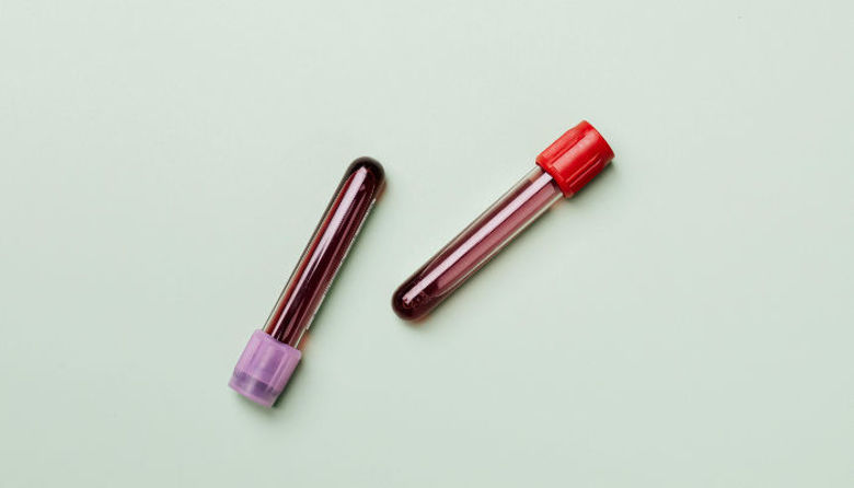 Picture of Holesterol v krvi