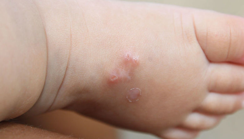 Picture of Garje pri ljudeh