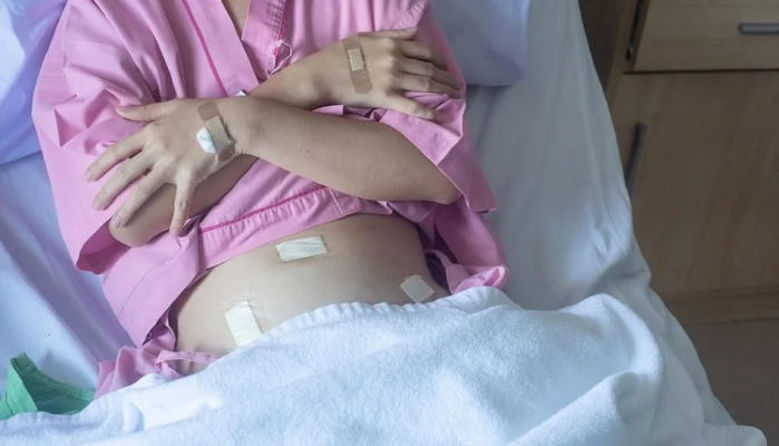 Picture of Koliko časa traja okrevanje po odstranitvi maternice?