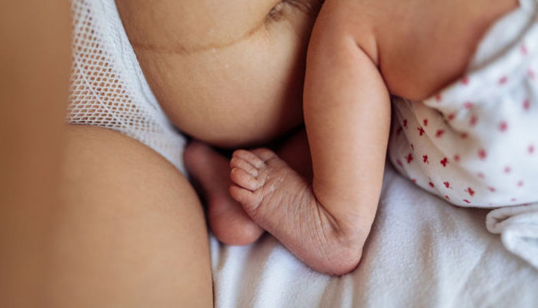 Picture of Čišča po porodu