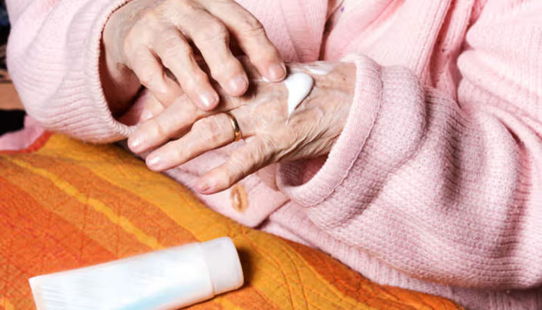 Picture of Mazilo za revmatoidni artritis