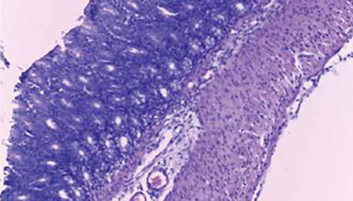 želodec-in-detralex